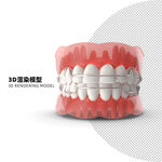 口腔矯正3D渲染模型