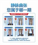靜脈曲張分期圖