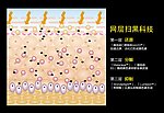 网层扫黑科技