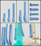 医疗器械 医疗钢板