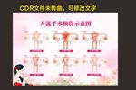 人流损伤示意图