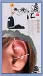 针灸