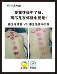 墨玉泡浴对比图