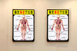 痛症穴位图
