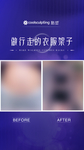 酷塑  医美  对比   海报
