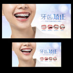 牙齿矫正