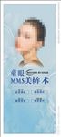 美眸术 双眼皮 韩式双眼皮 眼