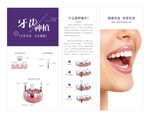 牙齿种植