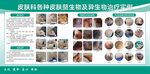 皮肤科各种皮肤赘生物及异生物治