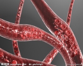 血管堵塞淤积动画