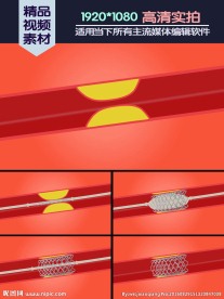 心梗支架置入术医学演示动画