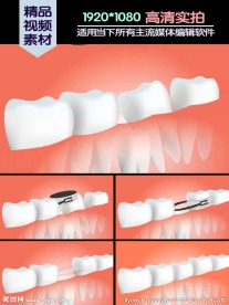牙正畸手术医学演示