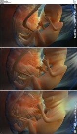 子宫胎儿医学演示动画