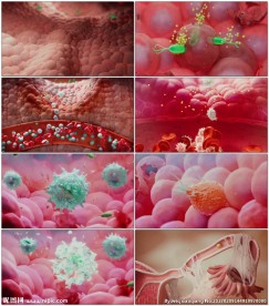 卵巢感染病菌坏死