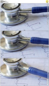 医院听诊器和打印输出的心电图