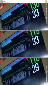 医院心电图监视仪