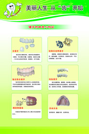 镶牙的种类和特征