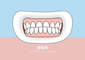 牙齿问题-地包天