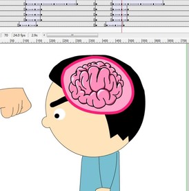 一个人被拳击后的脑袋反应4秒