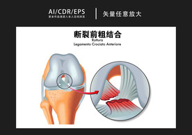 矢量医学骨科骨骼图解插画