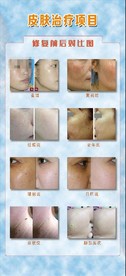 皮肤修复项目