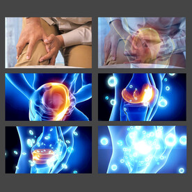 关节酸痛合成视频素材