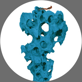 轻奢装饰画 假山 小鸟