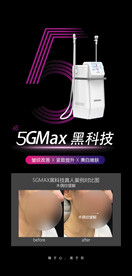 5GMAX天使光雕