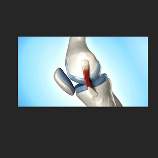 关节活动骨骼健康动画