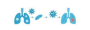 肺部与病毒相关医学图示