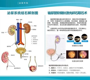 输尿管软镜钬激光碎石取石术
