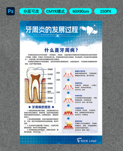 牙周炎的发展过程