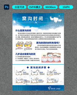窝沟封闭