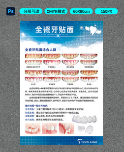 全瓷牙贴面