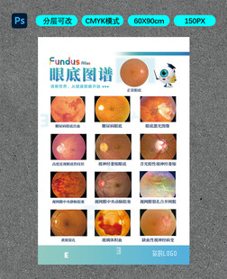 眼底图谱